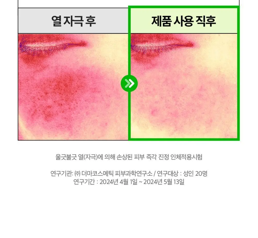 [흔적수분크림] 듀이트리 AC 딥 흔적 진정 크림 60ml 상세페이지 26